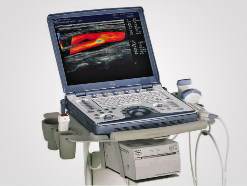 Duplex Ultrasound